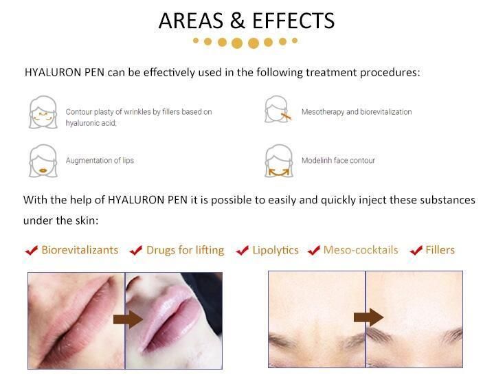 2019 Feelderma Needle Free Lip Filler Injector Hyaluronic Pen Anti-Wrinkles Meso Hyaluronic Injection Pen 0.3