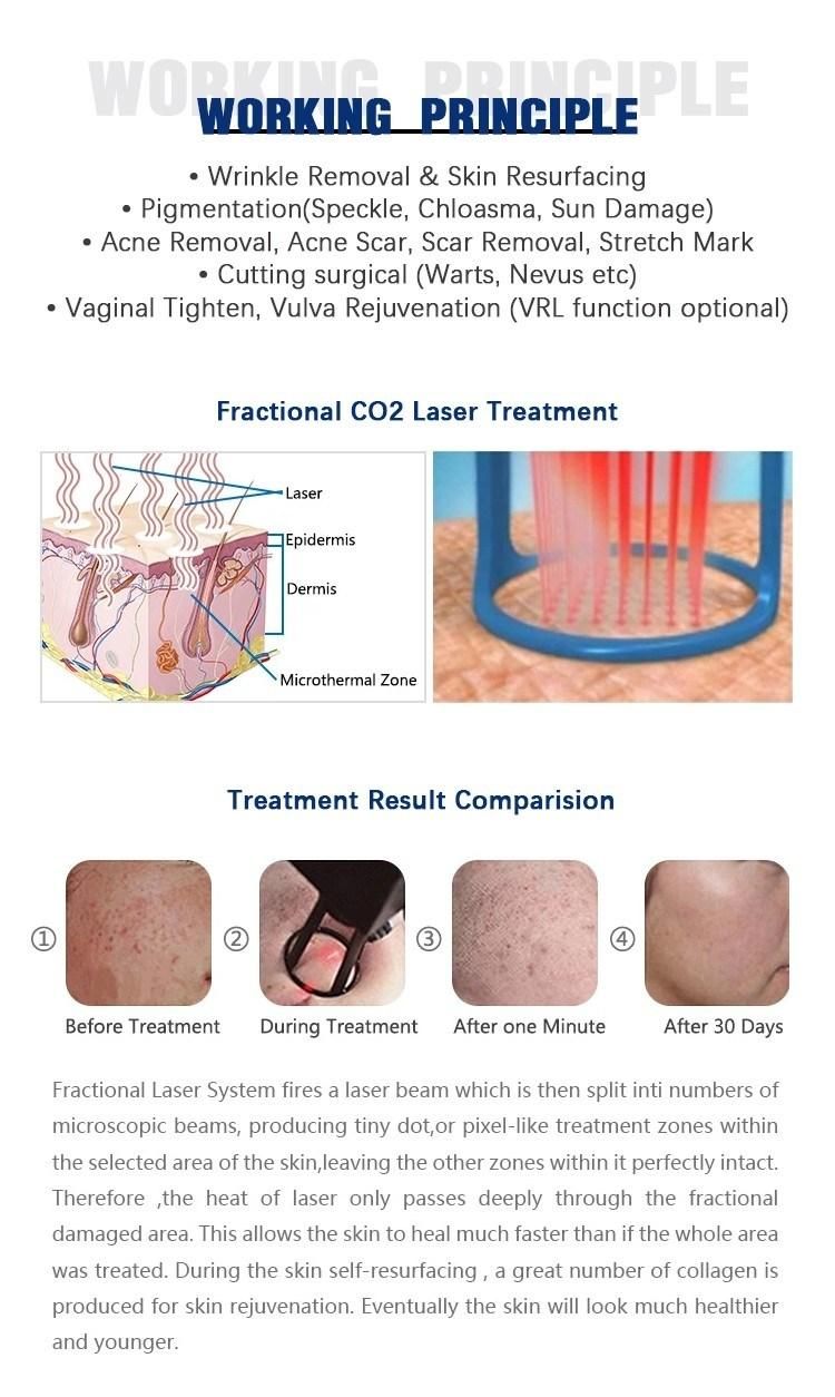 FDA Approved C02 Fractional Laser Beauty Machine for Skin Vaginal Resurfacing