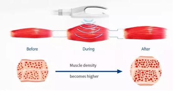 RF Muscle Building EMS Machine Non-Invasive High Intensity Body Slimming Machine