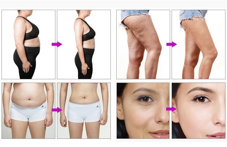 6-in-1 Cavitation Slimming System for Face and Body