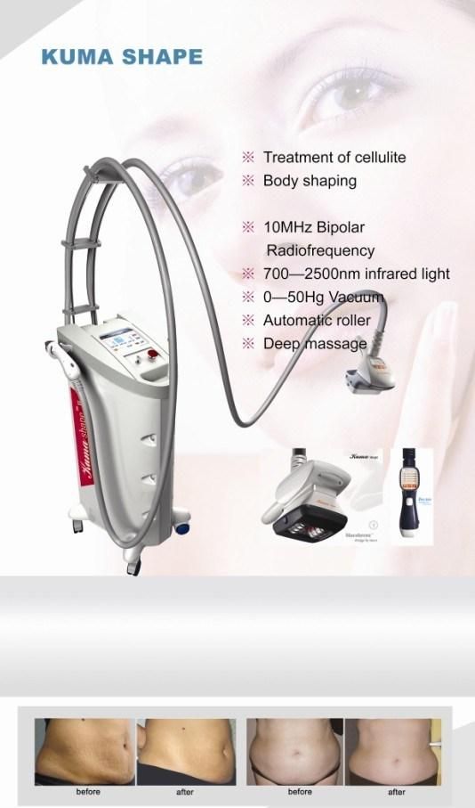 Fast Body Slimming Machine Kuma Shape 3 Cellulite Removal! Instant Remove Facial