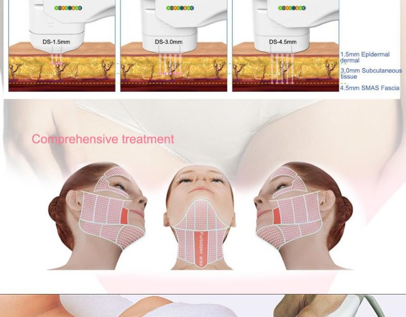 Ultrasound Hifu Beauty Equipment for Wrinkles Removal and Skin Tightening