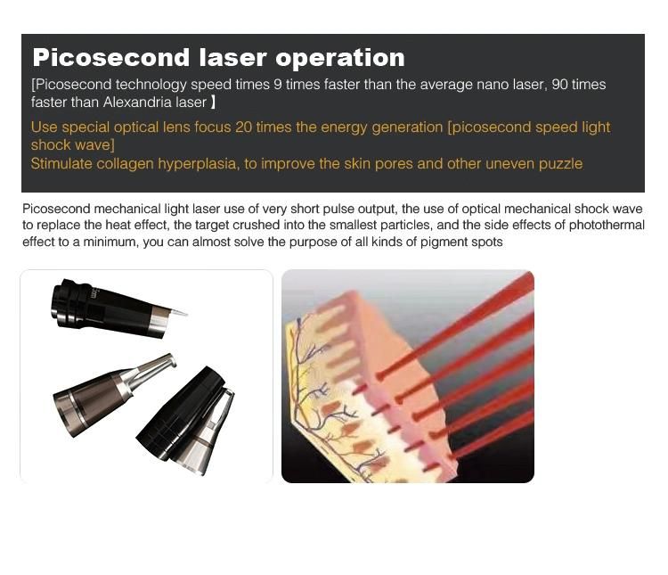 Guangzhou Factory Picosecond Pulsed Laser Tattoo Removal Specialist