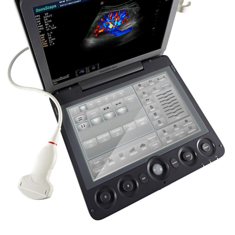Sonoscape S9 Medical Echography Portable Ultrasound Machine 3D 4D