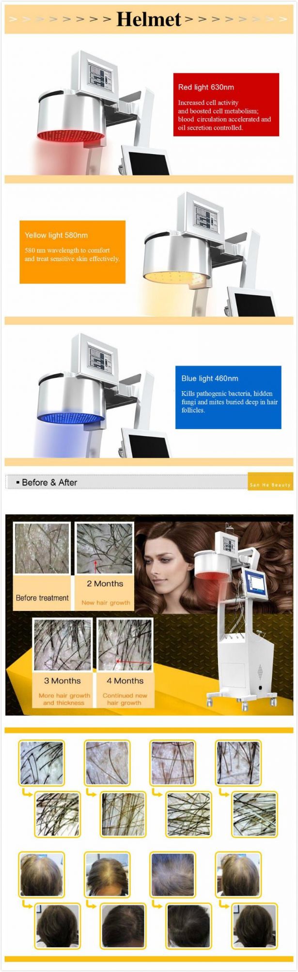 Laser Therapy Hair Growth Hair Growth Laser Comb Laser Hair Growth Machine