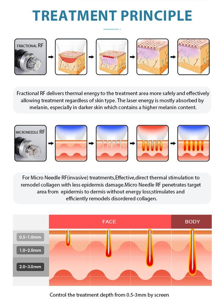 Microneedle RF Wrinkle Removal Skin Rejuvenation