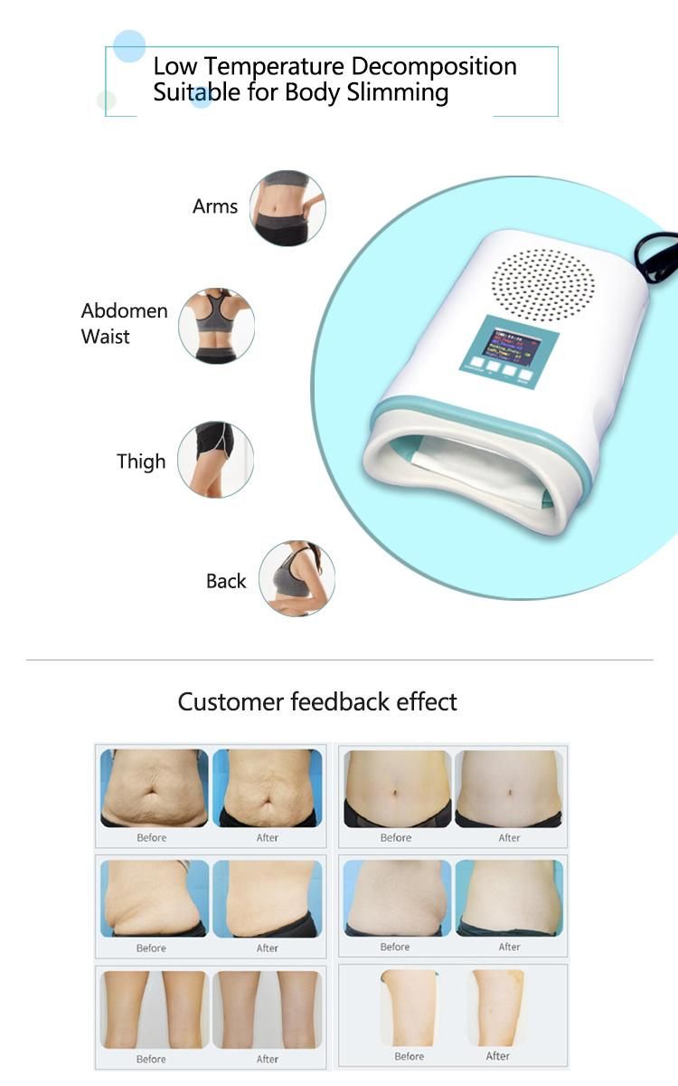 Mini Cryo Pad Slimming with Cooling System Machine Mini Body Freeze Weigh Loss Cool Tech Fat Freezing Cryolipolysis Machine Home Use