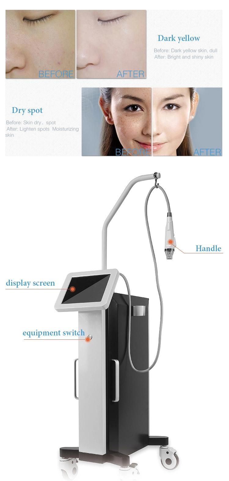 Fractional RF Microneedle Skin Tightening / Face Lifting Machine