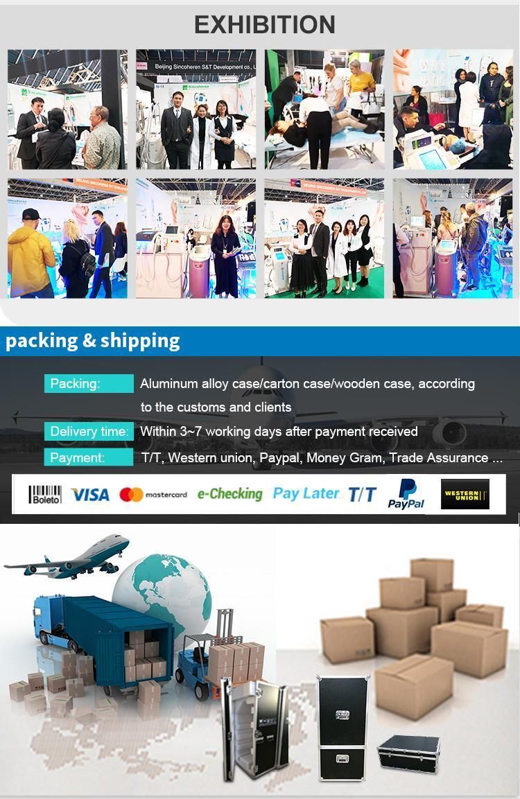 2021 New Arrivals Factory Price Imported Parts Free Shipping Ideas TUV 30000000-Shots 755 808 1064 Diode Laser Hair Removal Machine for Sale Xsw