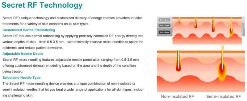 Az RF Micro- Needling Skin Rejuvenation Skin Tightening