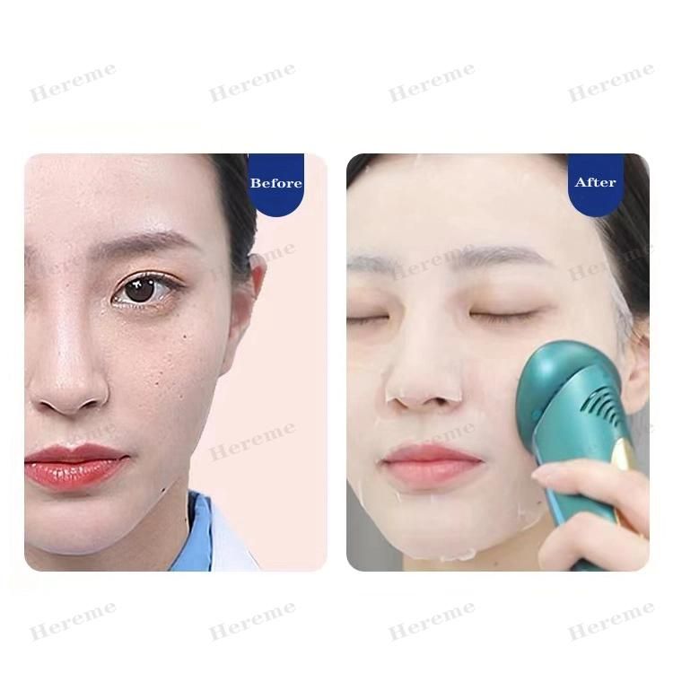 Heremefill Sells Hot Selling Firming Skin Beauty Instrument Multi-Functional Tender Skin Care Instrument