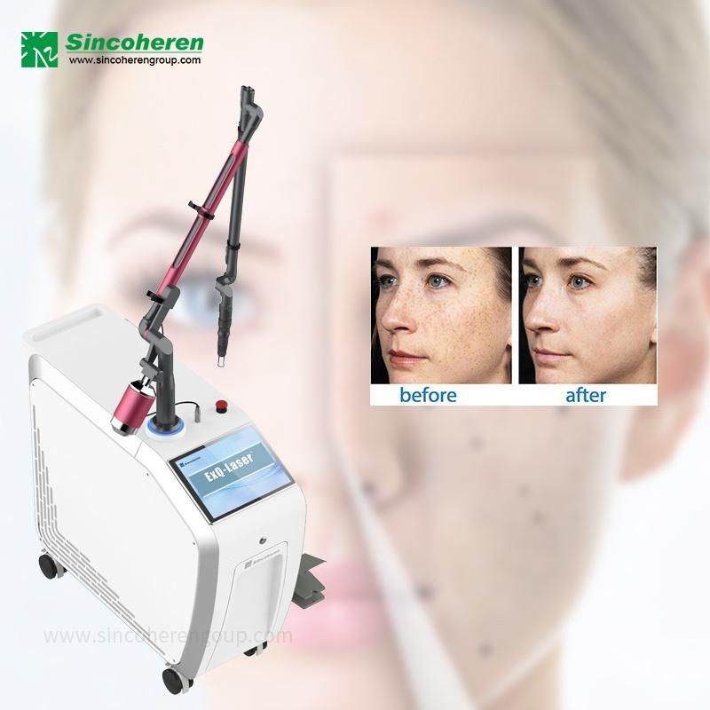 Professional Q Switched ND YAG 1064nm 532nm Picosecond Laser Tattoo Removal Machine