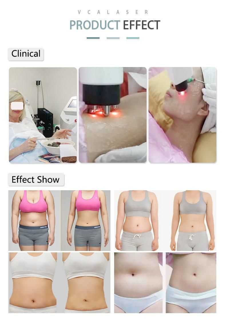 Promotion Skin Care RF Weight Loss Face Lifting Cavitation Laser Vacuum Beauty Slimming Machine
