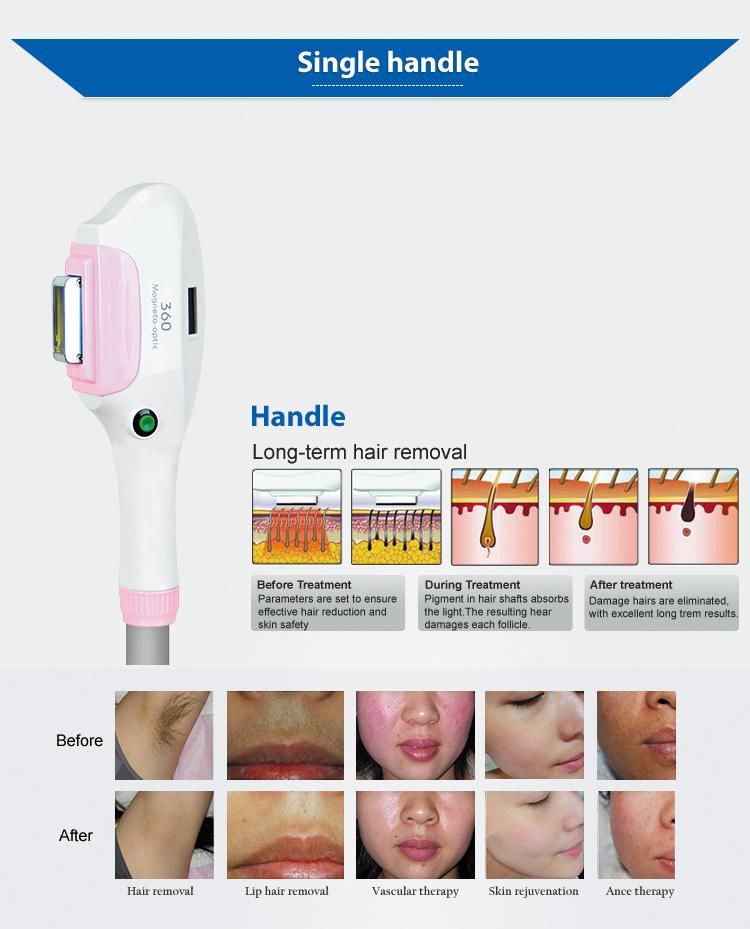 Vertical Style Magneto-Optical Elight IPL Hair Removal IPL Opt Shr Beauty Equipment