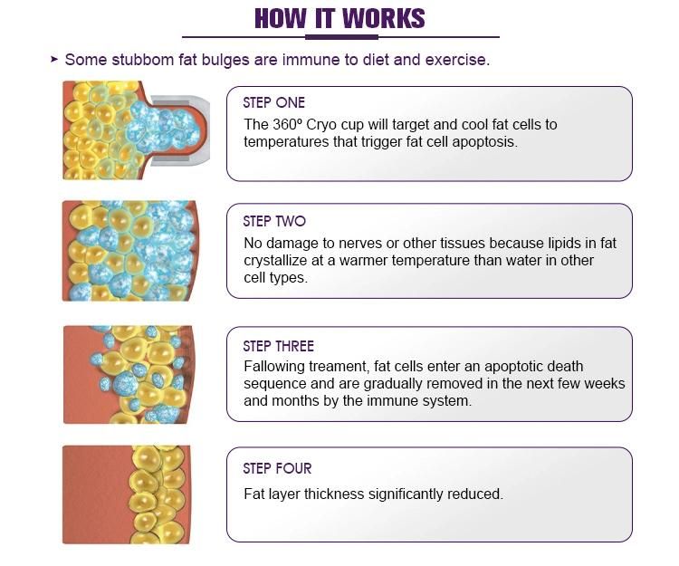 Cryotherapy Fat Removal Machine