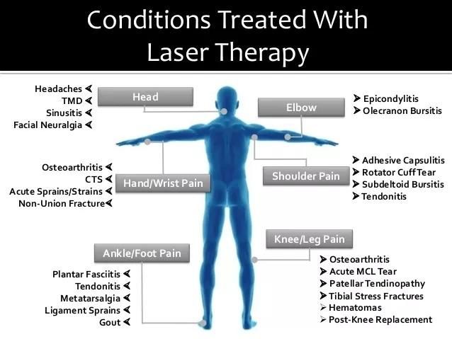 980nm Diode Laser Physiotherapy Treatment