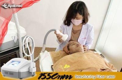 1550nm Fractional Effective 15W Fiber Fractional Laser Machine for Skin Toning