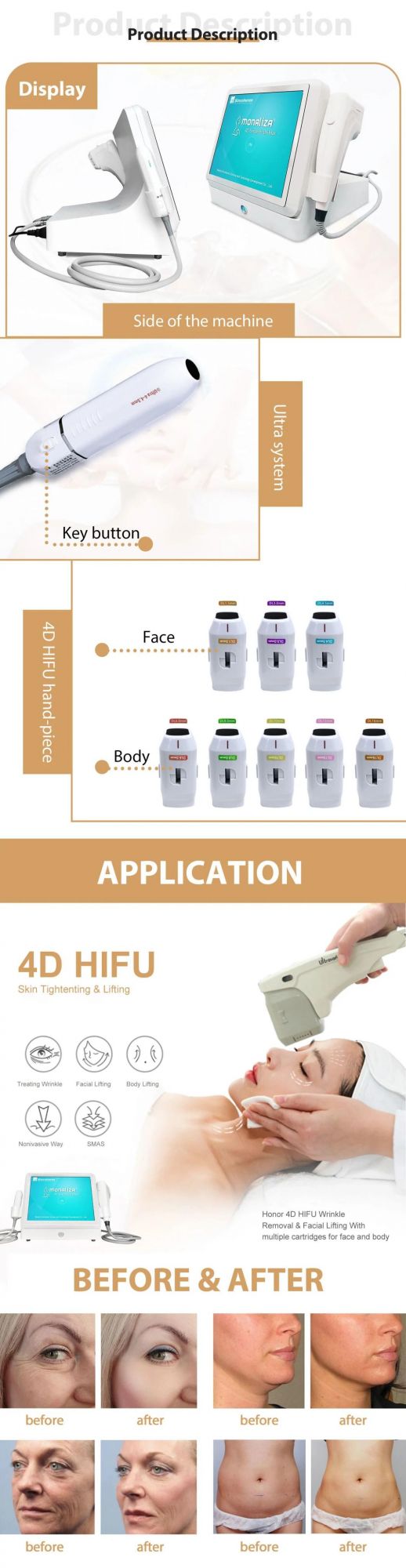 Hifu Ultrasound Machine for Skin Tightening and Fat Removal Wrinkle with 2 Handles and 6 Cartridges Hifu Machine