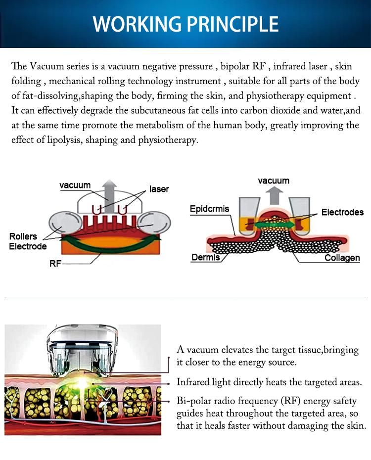 Professional Body Cellulite Removal RF Vacuum Slimming Machine