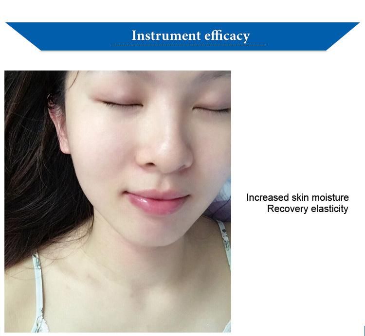 Radio Frequency Facial Equipment Hydro Microdermabrasion Machine