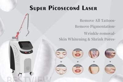 Beauty Machine Picosecond Laser Machine for Tattoo Removal