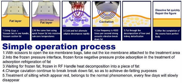 2018 New Designed 2 Cryolipolysis + Cavitation+ RF Fat Freeze Slimming Machine