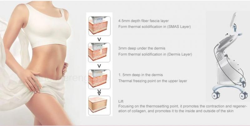 30% off Ultraformer III 4D 7D Hifu Wrinkle Removal Face Lifting Ultrasound Focus Machine