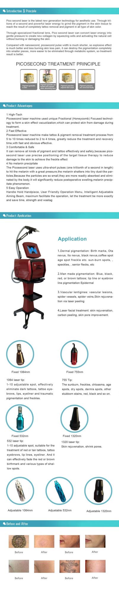 Factory Wholesale Picolaser Q-Switched ND YAG Laser for Tattoo Removal