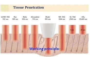 Whole Sale Taiwan Tech Triple-Wave Diode Laser Factory Directly Offer