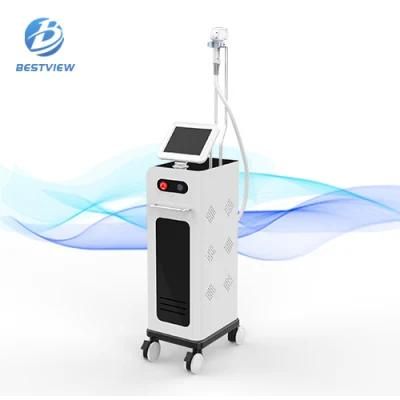 Diode Laser+Alexandrite+Ndyag Qswitch Diode Laser 3 in 1 Hair Removal Machine