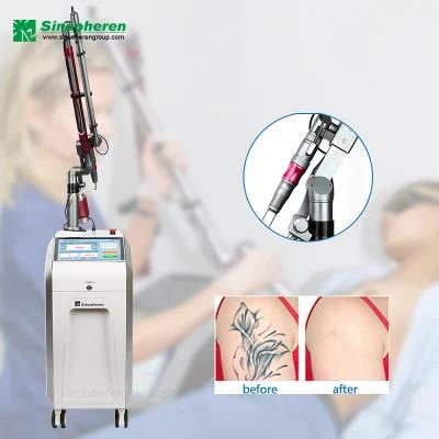 Picosecond Laser Machine Laser Tattoo Removal Agents Required ND YAG Q-Switch Laser