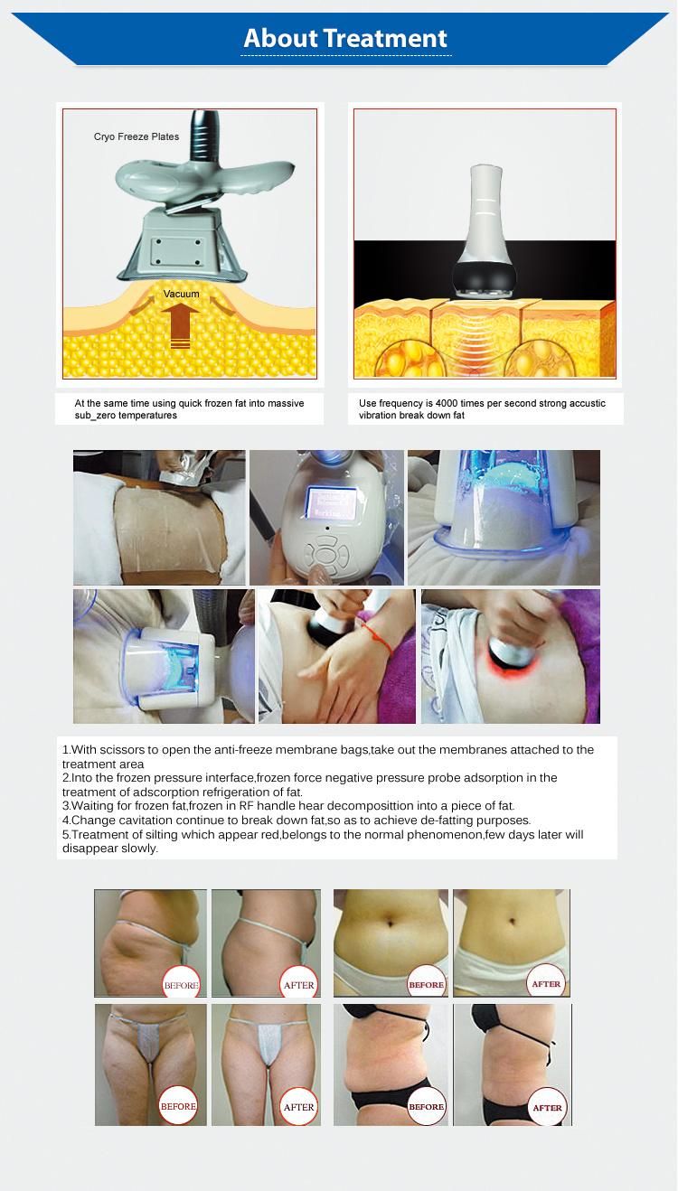 Lipo Ultrasonic Cavitation Cryolipolysis Slimming Weight Loss Machine