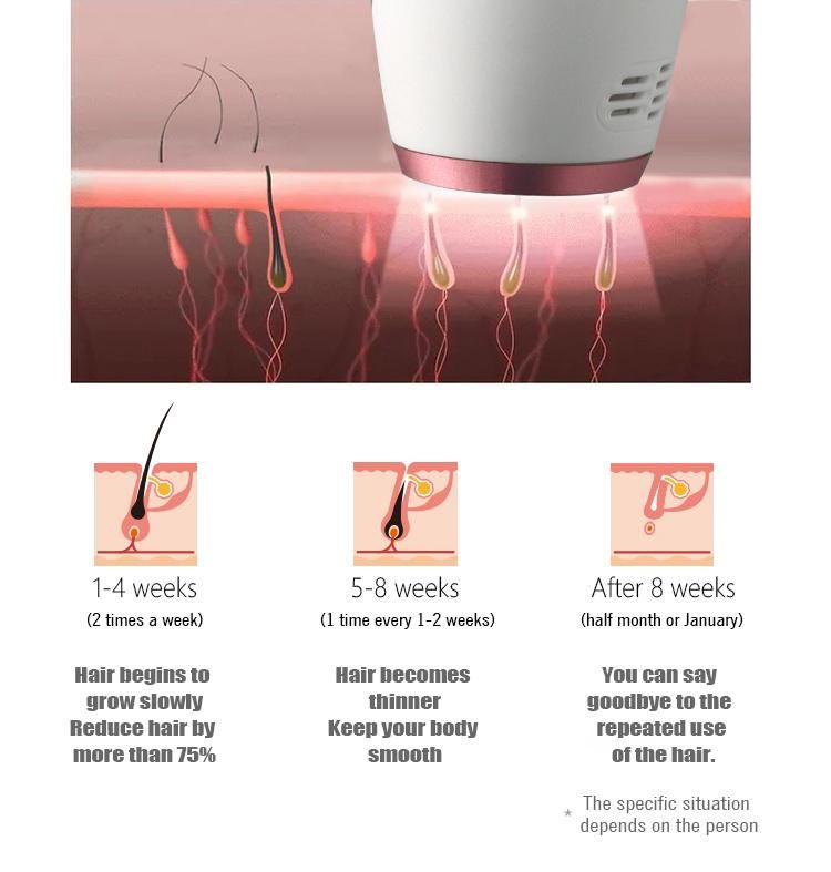 Handheld 808nm Diode Laser Hair Removal Machine at Home