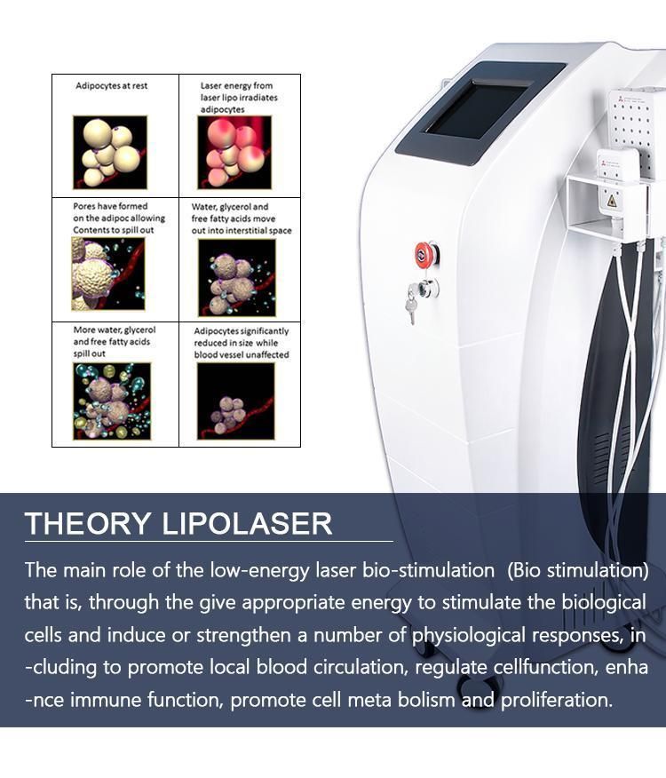 Laser Beauty Machine with 408 Diodes Lipo Laser for Cellulite Remove