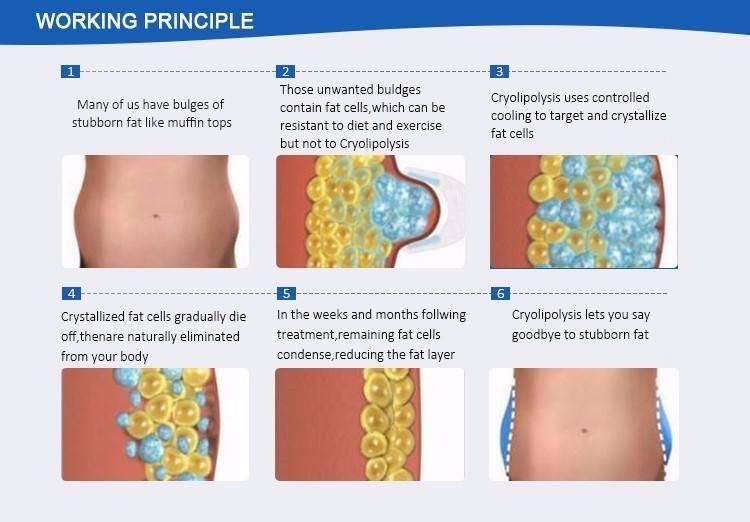 Promotion Price Coolplas Machine for Body Cellulite Reduction Machine with CE