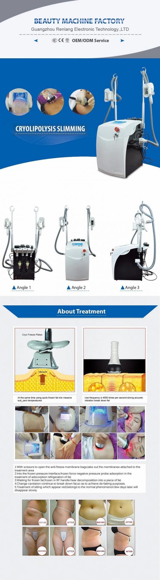 6 in 1 Portable Double Cryolipolysis Cryo + Three RF +One Cavitation Beauty Machine for Fast Slimming