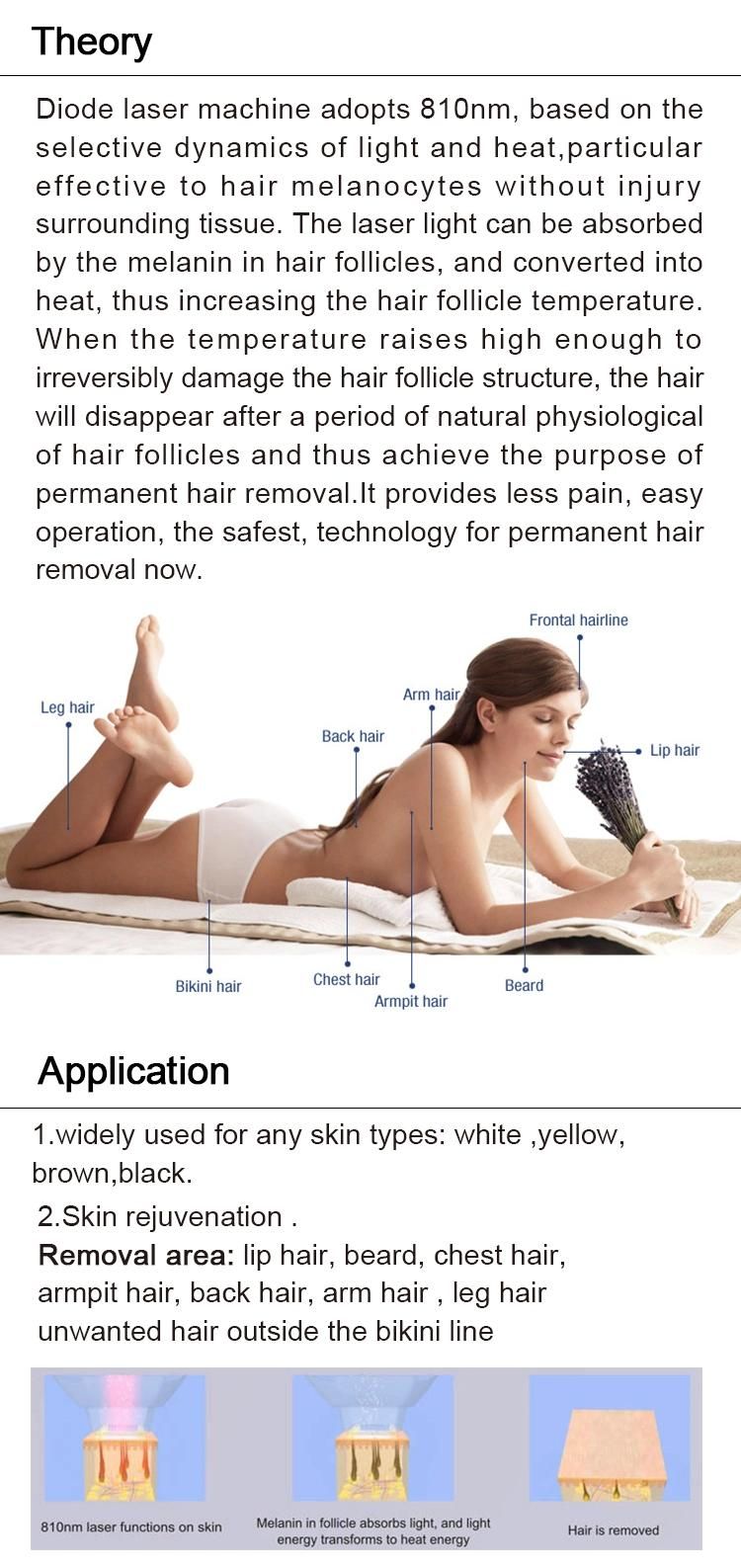 Portable High Power Diode Laser Hair Removal Machine