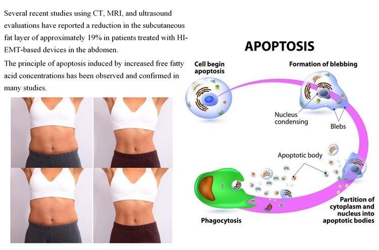 Portable Non-Invasive High Intensity Electromagnetic Muscle Trainer Machine