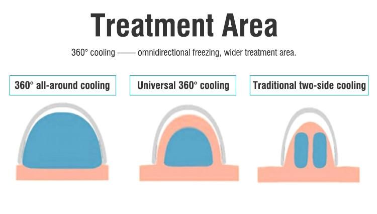 Portable 360° Two-Handle Vacuum Fat Freezing Machine