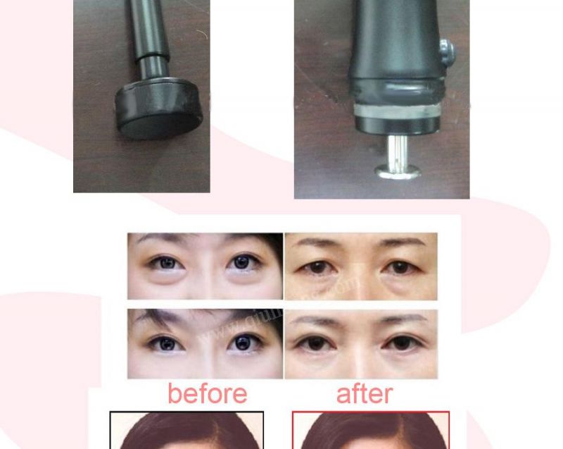 Needle Free Mesotherapy Wrinkle Removal Therapy Machine