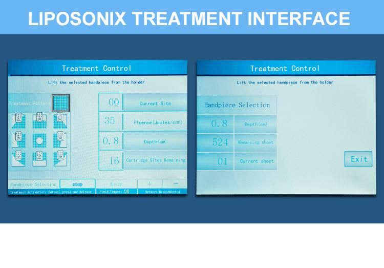 2018 Ultrashape Liposonic Hifu for Body Liposonix Suppliers