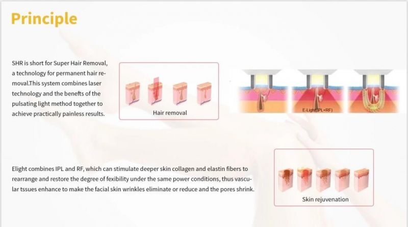 Multifunction Shr Elight IPL Opt Super Hair Removal Skin Rejuvenation IPL Laser Machine Permanent Beauty Facial Skin Care