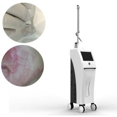Professional Surgical CO2 Fractional Laser Scar Remove Beauty Machine