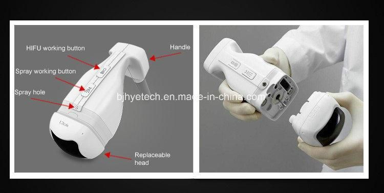 Vertical Non-Invasive Fat Reduction Liposonix Hifu Machine