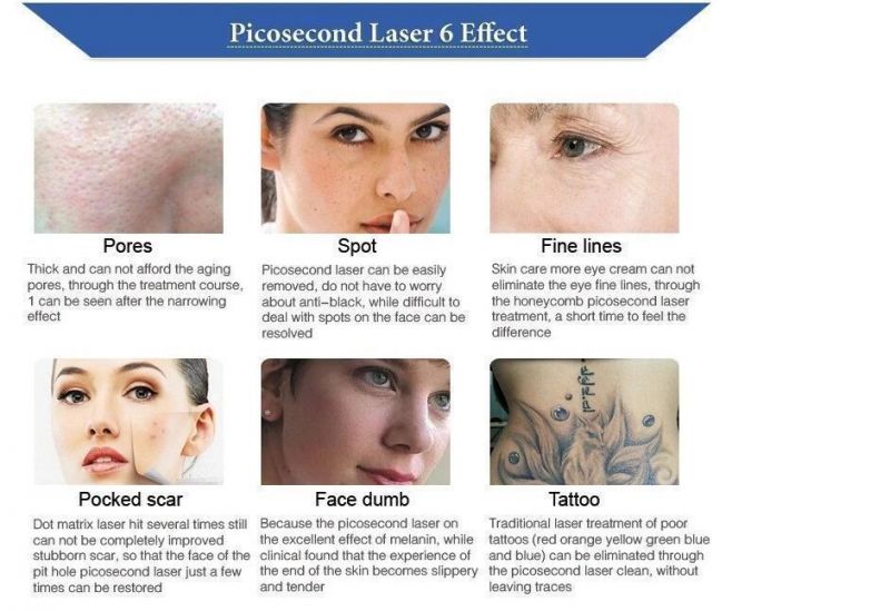 Picosecond Laser Pen Light Therapy Melasma Tattoo Skin Toning Removal Pico Laser Esthetic Salon Machine