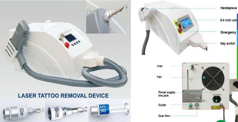 V-Acne Treatment Pigment Removal Pigment Removal YAG Laser