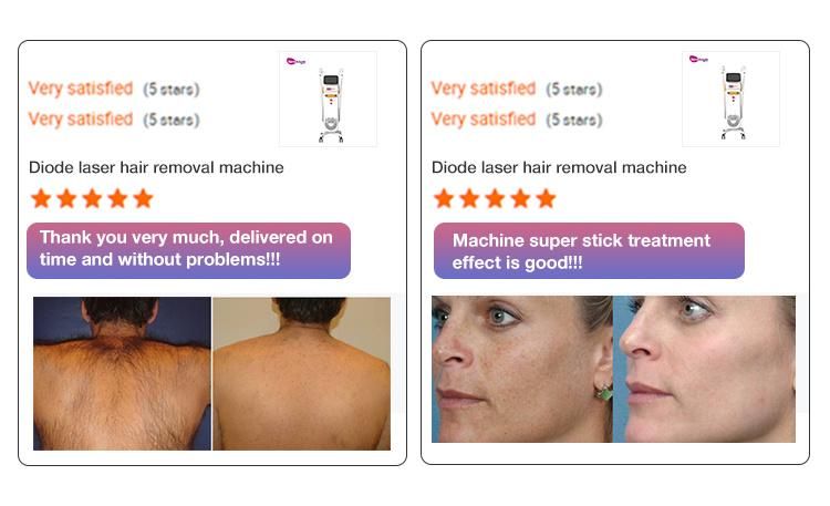 All Skin Types 2 Handles Skin Whitening Dpl RF Laser Hair Removal Machine IPL