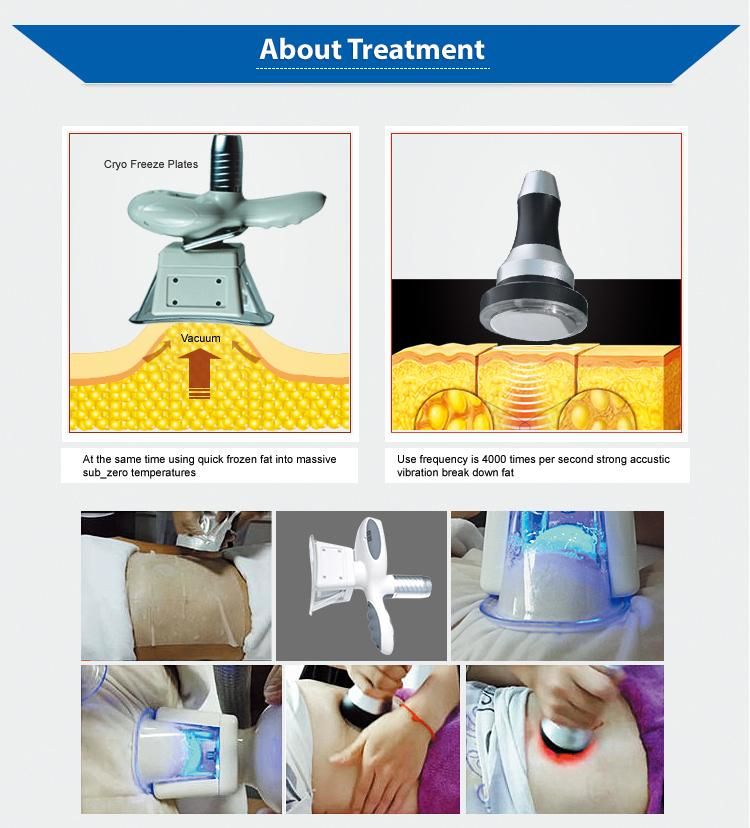 Double Chin Reducer Cryolipolysis Apparatus