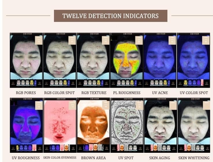 3D Digital Facial Analysis Skin Analyzer Machine