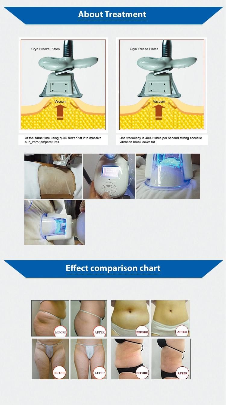 Cryolipolysis RF Body Contouring Treatment Cavitation Machine Body Slimming